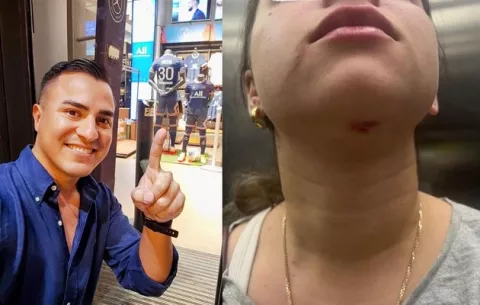 Rony Vargas, en aprietos por presunta agresión a su novia