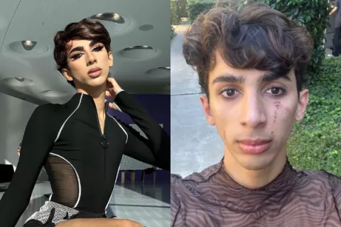 Alex Dimension reveló que su agresor fue detenido