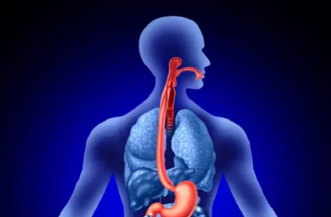 Cáncer de esófago: ¿'Tips' para prevenir esta dolencia?