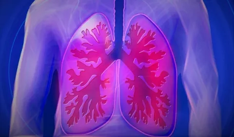 Cáncer de pulmón, por una detección temprana