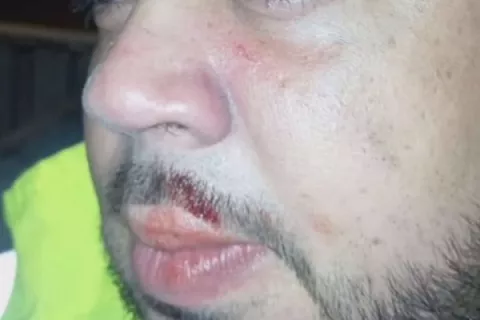 Agreden al personal de salud en los cierres de Colón  