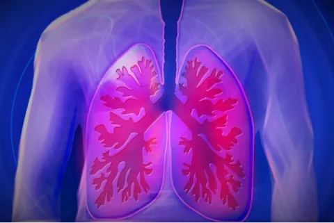Cáncer de pulmón: ¿Qué debe saber?