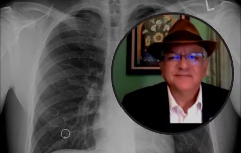 Urge priorizar niños y adolescentes frente a la tuberculosis