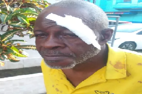 Agreden con un palo  a un trabajador de Aguaseo en Colón