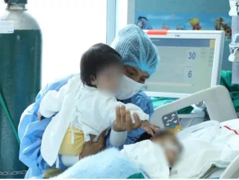 Separan con éxito a siameses unidos por el abdomen