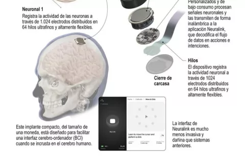 Telepathy, primer chip cerebral implantado a un ser humano