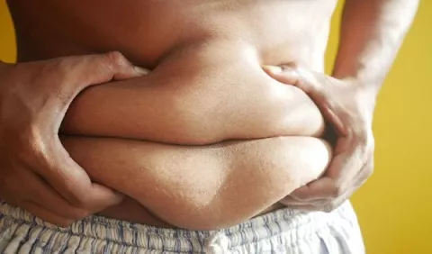 Obesidad, eliminando estigmas