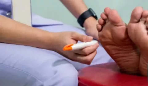 Pie diabético: ¿Cuál es su impacto en los pacientes?