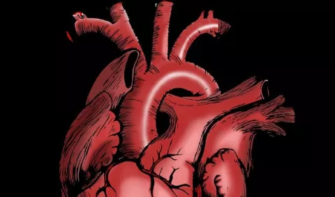 Ataque cardiaco: Señales de emergencia