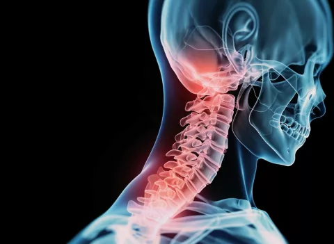 Cirugía de columna vertebral en Bogotá: innovación médica de alcance global