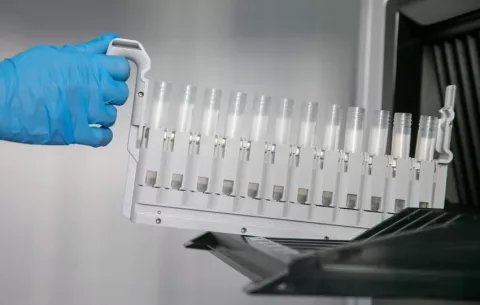 Científicos alertan ante la amenaza de enfermedades causadas por hongos 