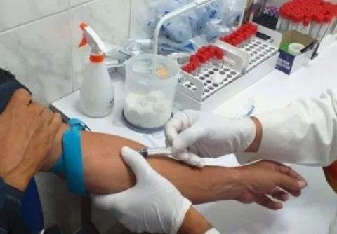 Estrategias para mejorar la atención en la clínicas para tratamientos de VIH en Panamá Oeste