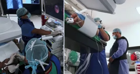 CSS: técnicas para diagnósticos más certeros en el estudio de los pulmones 