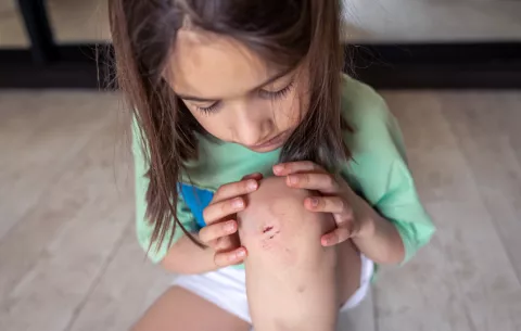 Medidas para prevenir caídas o accidentes infantiles