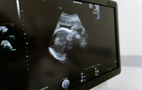 ¿Qué opinan las panameñas sobre la esterilización a menores de edad?