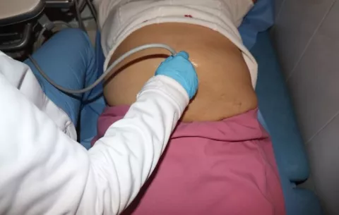 Trastornos del piso pélvico en mujeres: ¿Cuáles son las opciones de tratamiento?