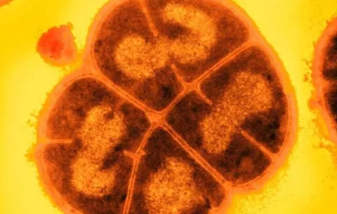Conan, bacteria que tolera dosis de radiación superiores a las que matarían a un humano
