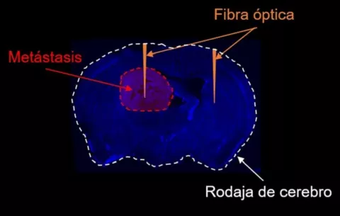Desarrollan una linterna molecular para detectar metástasis en zonas profundas del cerebro