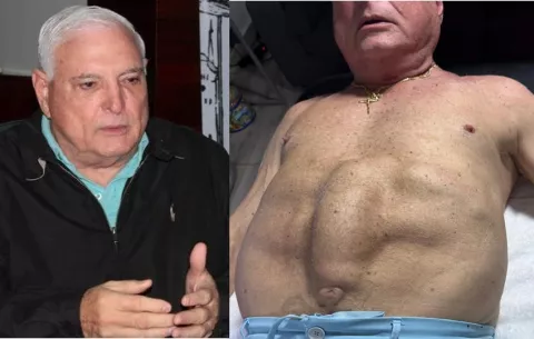Martinelli muestra la gravedad de sus problemas médicos: 'Esta es la operación que me tengo que hacer'