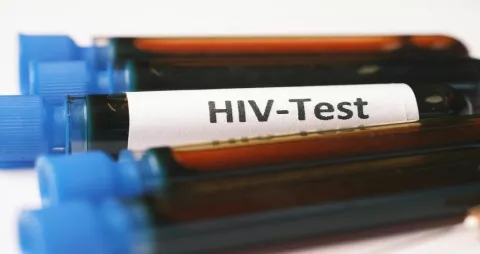 ¡Cuidado! carnavales multiplican casos de VIH a nivel nacional