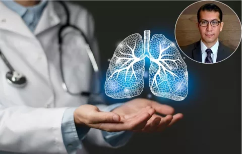 Cáncer de pulmón: ¿Qué tan receptivos son los pacientes a probar nuevas opciones de terapias?