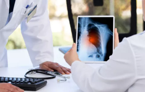 Tuberculosis: ¿qué factores inciden en el incremento de los casos?
