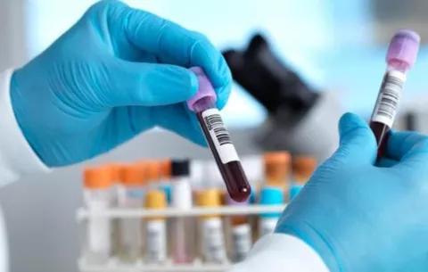 Panamá registra 243 casos del virus Oropouche y una defunción 