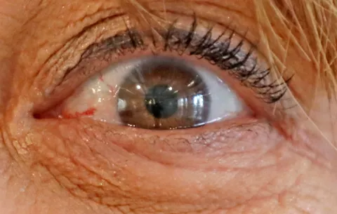 Hong Kong usa IA para predecir alzhéimer a través de las retinas