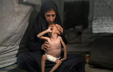 Enfermos y desnutridos, los niños de Gaza que Israel llama fake news también pasan hambre