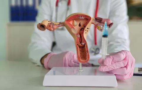 ¿Cómo el rejuvenecimiento ovárico puede ayudar a las mujeres de edad materna avanzada?