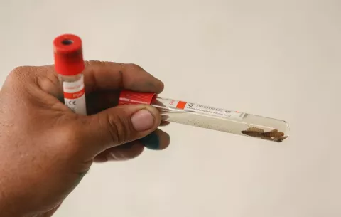 Plaga del gusano barrenador está "muy ligada a la falta de higiene y la pobreza"