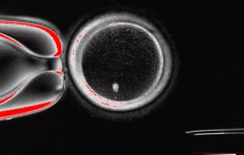 Desarrollan óvulos humanos potencialmente fecundables a partir de células de la piel