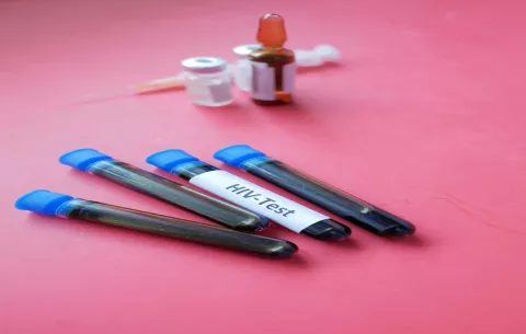 Las infecciones de transmisión sexual siguen en aumento en el país