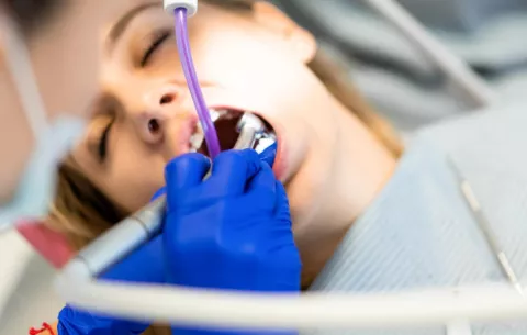 Señales de que necesitas una profilaxis dental