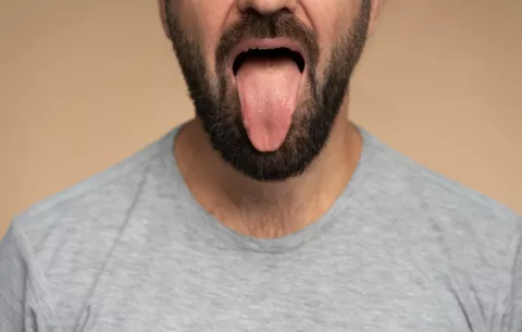Mitos y verdades de la halitosis