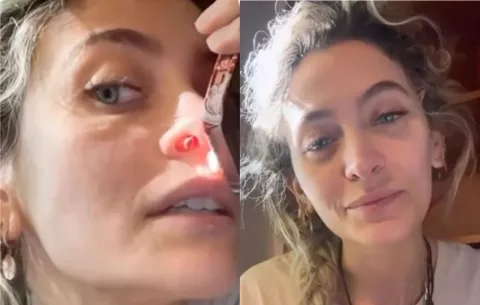 Paris Jackson revela que el consumo de drogas le ha perforado el tabique nasal