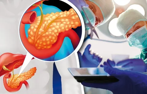 Cáncer, la amenaza creciente del páncreas