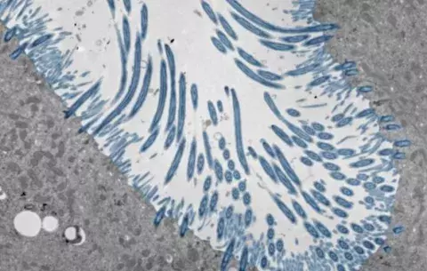 Fosas nasales defienden del resfriado común y ayudan a determinar la gravedad de la enfermedad