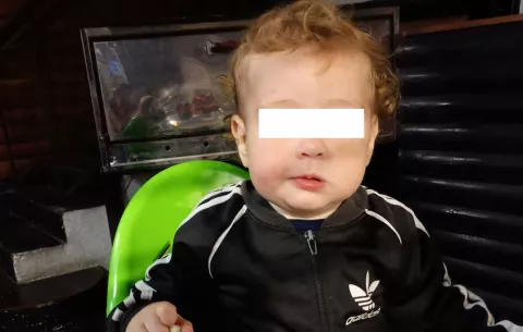 Muere bebé de un año tras asfixiarse con una uña postiza