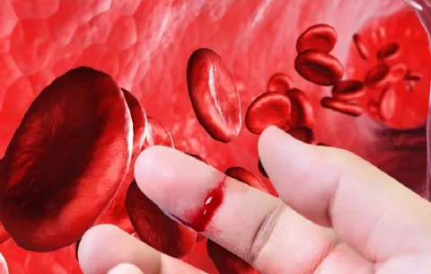 Panamá hace historia con las primeras guías nacionales para la hemofilia
