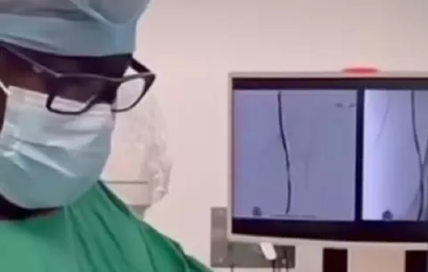 Realizan primera revascularización endovascular en el hospital Dr. Amador Guerrero de Colón