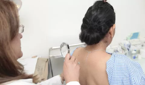Cáncer de piel sigue marcando entre los más comunes del país