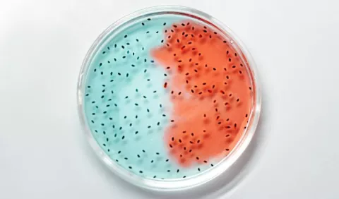 Gorgas analiza varias cepas de influenza