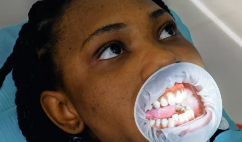 ¡Cuida tus dientes originales! 
