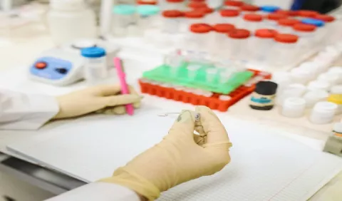 VIH en Panamá: miles viven con el virus sin saberlo