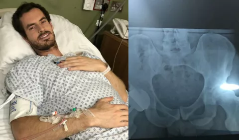 Radiografía deja ver el pene de Andy Murray