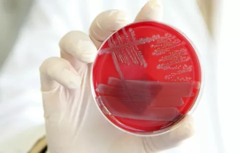 Muere una mujer en Florida tras contraer la bacteria come-carne en una playa