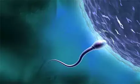 Una viuda gana batalla legal para preservar el esperma de su marido
