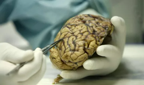 Cerebro con superpoderes