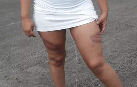 Mujeres son golpeadas por policías en Chiriquí e interponen la denuncia 